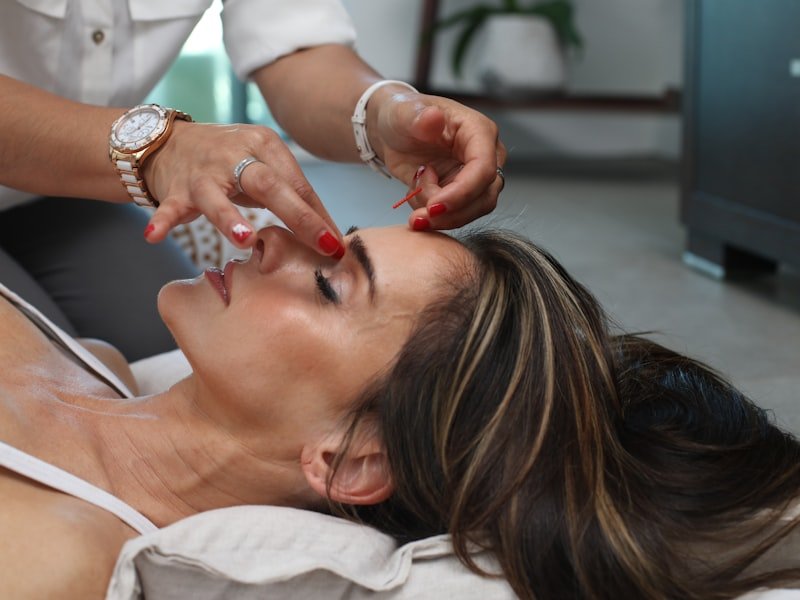 Acupuncture treatment — fine sterile single-use needles applied to the face